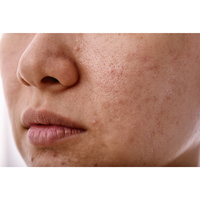 Dehydrated-Looking Skin