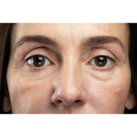 Dull, Tired-Looking Skin