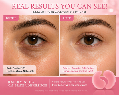 Instant Glow Eye Patches