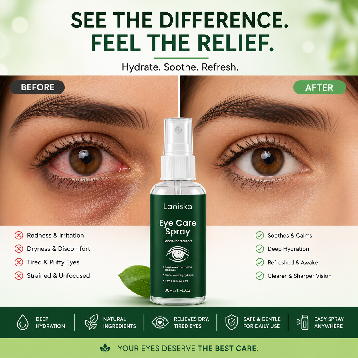 EyeRelief Spray